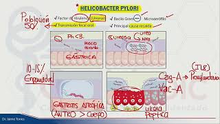 GASTROENTEROLOGÍA  ÚLCERA PÉPTICA [upl. by Sorci]