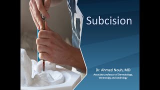 Subcision with English subtitles [upl. by Nevetse]