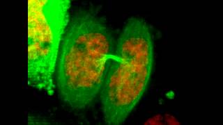 Mitosis in 2D  HeLa Cell Undergoes Mitosis [upl. by Faunia]