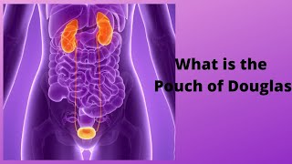 What is the Pouch of Douglas [upl. by Senecal]