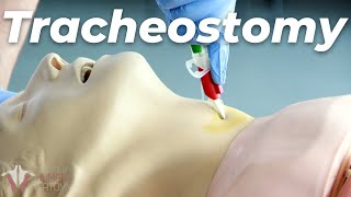 How to Perform a Tracheostomy [upl. by Dorina186]