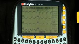 ReadyLink 12LEAD ECG Training Video [upl. by Dora206]