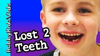 HobbyFrog LOST FIRST 2 TEETH His First Teeth Gone  Story How He Lost Them HobbyKidsVids [upl. by Peppard]