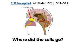 Is Intranasal Delivery of Stem Cells to Treat brain Disease a Real Thing [upl. by Ileyan]