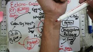 echinococcusgranulosus🌹🌹 echinococcus 2 life cycle parasitology microbiology levinson [upl. by Revlis]