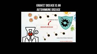 Graves disease is an autoimmune disease basedow gravesdisease autoimmunedisease thyroid [upl. by Erbua]