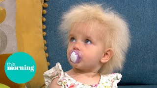 Meet The Toddler With UltraRare Wild Hair Diagnosis  This Morning [upl. by Livvi642]