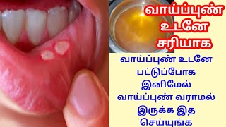 ஒரே நாளில் வாய் புண் பட்டு போக How To Cure Mouth Ulcer In Tamil vaipuntreatmentintamilhomeremedies [upl. by Jarita82]