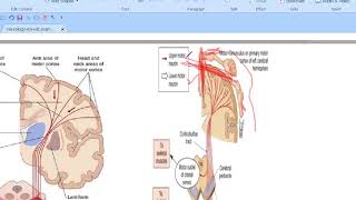 hemiplegia p1 [upl. by Amadis]