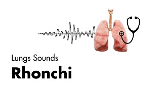 Rhonchi  Lung Sounds  Medzcool [upl. by Hildagarde461]