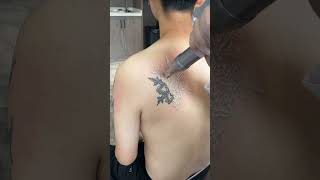 SCAR FREE TATTOO REMOVAL ep932 short [upl. by Annelg463]