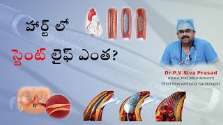 హార్ట్ లో స్టెంట్ లైఫ్ ఎంత  Dr Siva Prasads Hrudayalaya Best Cardiology Hospital Vijayawada [upl. by Meg]