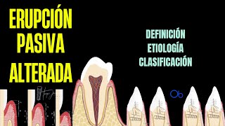 Erupción Pasiva Alterada qué es causas y clasificación [upl. by Alderson]