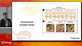 Management Of Bicuspid Aortic Valve Disease [upl. by Yrro]