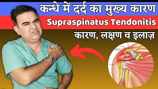 How to RELIEVE SUPRASPINATUS TENDONITIS  SHOULDER PAIN RELIEF EXERCISES [upl. by Mersey]