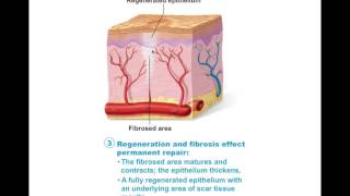 Chapter 47 Tissue Repair BIO201 [upl. by Slaby825]