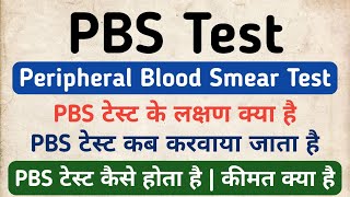 PBS Test in hindi  Peripheral Blood Smear Test in hindi  Symptoms amp Cost of PBS Test [upl. by Fredkin470]