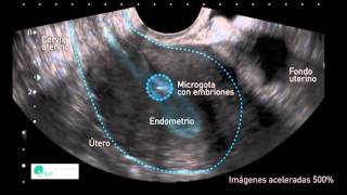 INSTITUT MARQUÈS  El útero mueve a los embriones para que se implanten correctamente [upl. by Fionnula854]