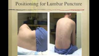 Lumbar Puncture [upl. by Ynohta]