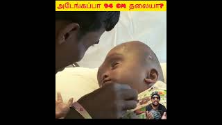 💥🤯 அடேங்கப்பா 94 CM தலையா⁉️😨 headfacts shortsfeed viral tamil [upl. by Nohsal454]