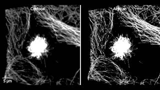 ZEISS LSM 880 Mitosis in tumor cells with Airyscan SR mode [upl. by Anilat]