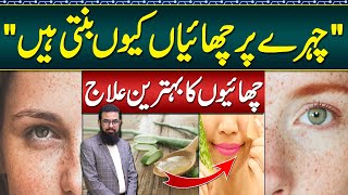 Melasma Treatment at Home  Melasma Cream and Melasma Home Remedies  Face Par Chaiyan Ka Ilaj [upl. by Allesig898]