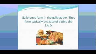 When to Worry About Gallstone Disease Symptoms [upl. by Azarcon423]