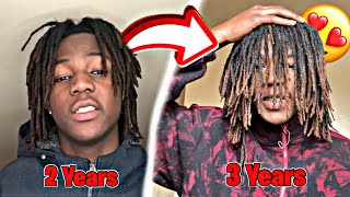 INSANE TRANSFORMATION Dread Journey 2 Years  3 Years [upl. by Aihsemaj388]