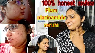 செம்ம changes💯product that changed my skin⭐️Niacinamide serumwhich is besthow to usehonest review [upl. by Yelrah]