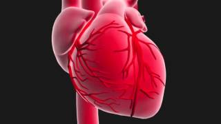 Questce quun infarctus du myocarde [upl. by Paco]