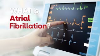 What is Atrial Fibrillation [upl. by Enivid870]