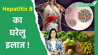 Hepatitis B Ka Gharelu Ilaj Symptoms Treatment In Hindi Goodlife [upl. by Eimarej]