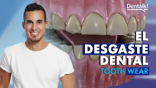 ¿DIENTES DESGASTADOS  Causa y TRATAMIENTO de abfracción atrición y otros desgastes  Dentalk © [upl. by Retsel]