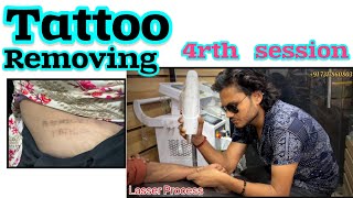 How to Remove tattoos  4rth session tattoos removal process tattoo removal tutorial stepbystep [upl. by Ayikan]