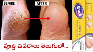 Krack Heel Repair Cream Uses in TeluguHow to Apply Krack CreamBest cream For Heals in Telugu [upl. by Robins]