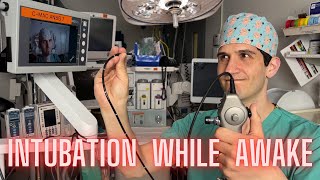 Why and how anesthesiologists intubate completely awake patients [upl. by Lawley637]