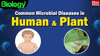 Common Microbial Diseases in Humans amp Plants  Biology  Home Revise [upl. by Lonna364]