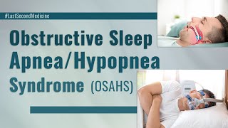 Obstructive Sleep Apnea Hypopnea Syndrome  What is it its diagnosis and treatment EXPLAINED [upl. by Damour]