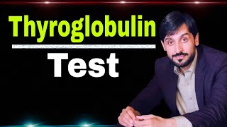 Thyroglobulin Test [upl. by Nahama]