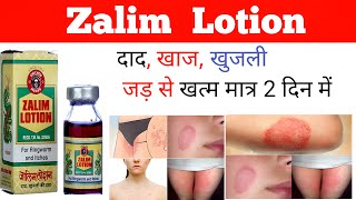 Zalim Lotion की सम्पूर्ण जानकारी  दाद खाज खुजली का पक्का इलाज़  उपयोग करना चाहिए या नहीं 💊💉💊🩺😷🥼 [upl. by Marlyn269]