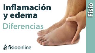 Inflamación y edema  Diferencias y características [upl. by Aiva]