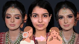 PIMPLE SKIN MAKEUP oily skin makeup tutorialLong lasting makeup Easy makeup tip BrushStories [upl. by Melisenda]