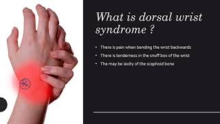 Dorsal Wrist Syndrome  Everything You Wanted to Know [upl. by Abla]