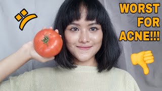 5 DAYS TOMATO MASK REVIEW ON ACNE PRONE SKIN IDENG [upl. by Hera]