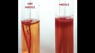 Motility Determination in Bacteria  Amrita University [upl. by Amadeo]