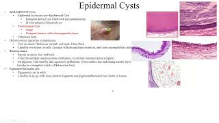 Pathology Made EasySystemic Pathology 14Skin Diseases4Epidermal proliferations and neoplasms1 [upl. by Fidele]