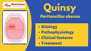 Quinsy  Peritonsillar abscess  Etiology clinical features treatment Mediklaas [upl. by Marlen218]