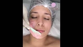 Tratamiento Facial Dermalaser Rejuvenece tu Piel con Tecnología Avanzada en Chiriquí y Santiago [upl. by Ecinnej840]