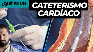 Que es un cateterismo cardiaco [upl. by Aderf]