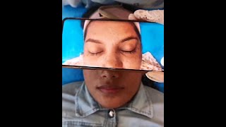 Microblading Eyebrows Treatment Before amp After DrAesthetix Clinic Chennai Dr Hemamalini Rajinikanth [upl. by Oech]